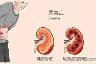 衰？特里皮尔战埃弗顿2次失误、战热刺2次被爆、战蓝军送礼+失点